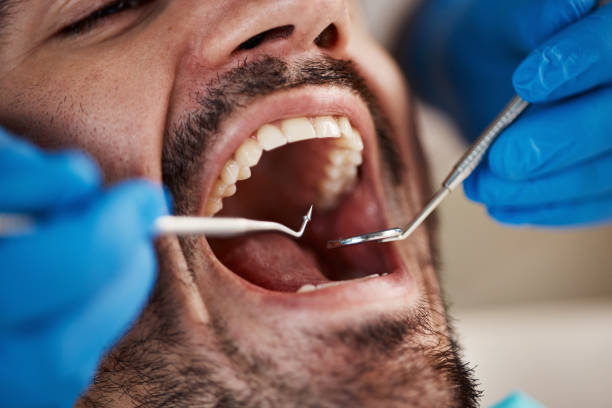 Best Emergency Dental Care for Abscessed Tooth in Cleveland, OK